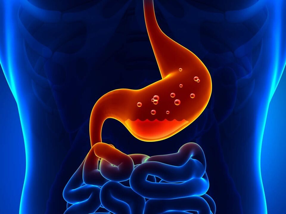 Gastritisa urdaileko hanturazko gaixotasuna da, dietak behar dituena